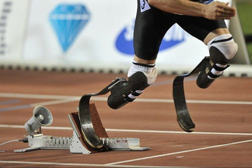 市場(chǎng)一般假肢價(jià)格是在多少呢(圖1)