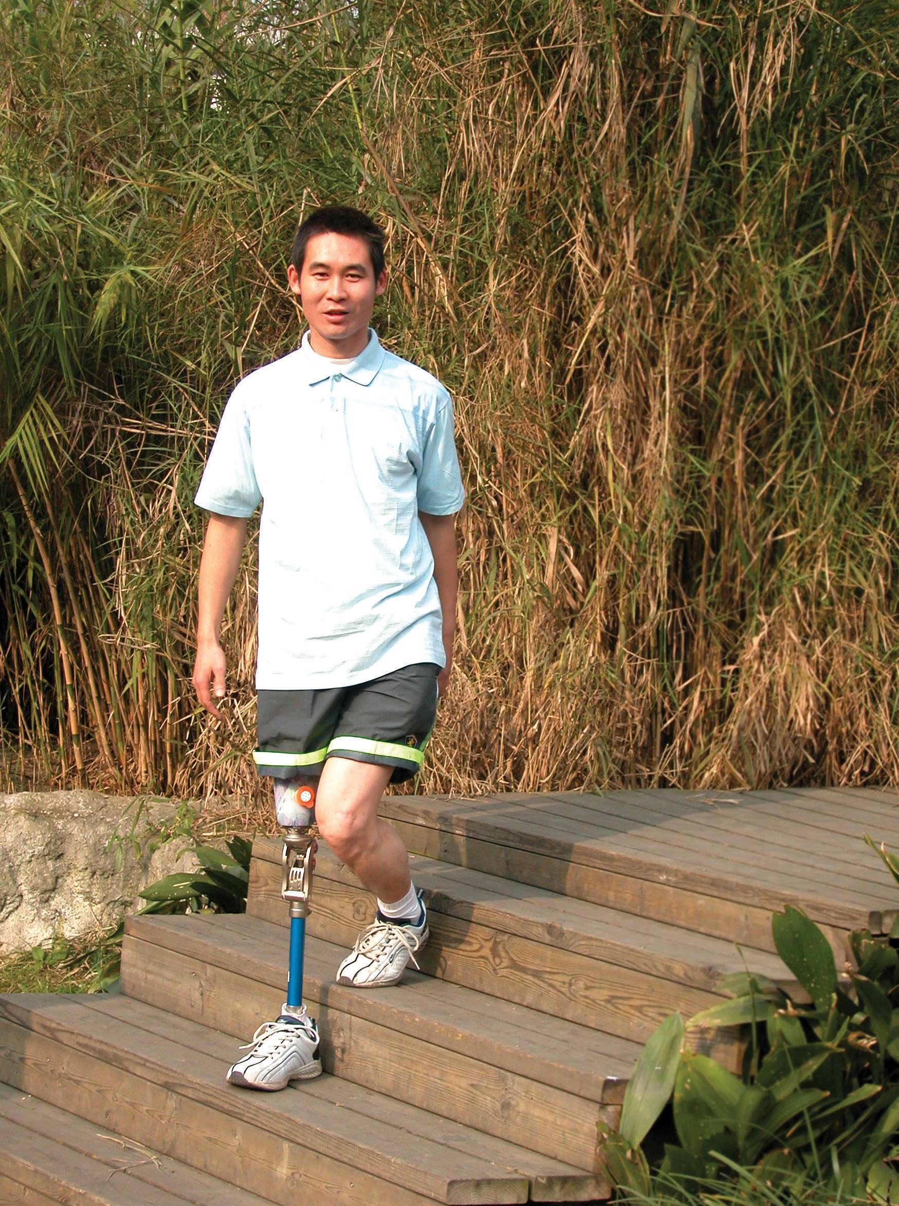 假肢價格便宜的可以選擇嗎?(圖1) 假肢價格便宜的可以選擇嗎?