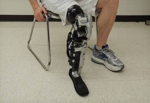 裝配一條腿的假肢價格大概多少錢?(圖1) 假肢價格