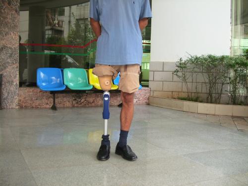 安裝假肢多久做一次訓練比較好?需要多長時間?(圖1) 假肢